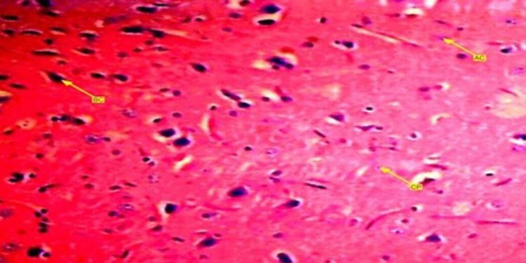 Article: Histomorphomertric Analysis Of Hormonal Contraceptive Pills On Anterior Pituitary Gland In Female Wister Rats