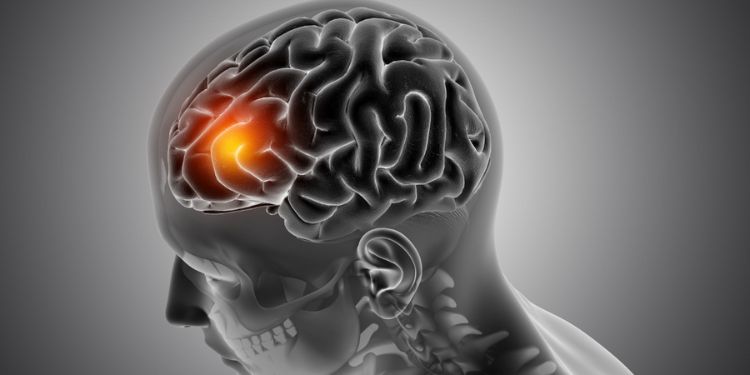 Article: Morphological Variations and Morphometric Analysis of Foramen Ovale in South Indian Population