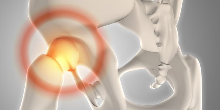 Journal of Aging Research and Healthcare - Hip Fractures