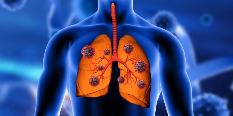 Article: Random Forest Classifier for Respiratory Mortality Analytics 